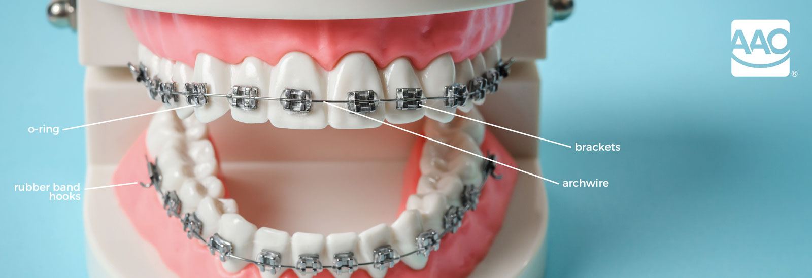 Emergency Orthodontic Little House of Smiles Children's Dentistry